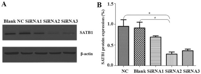 SATB1 Antibody in Western Blot (WB)