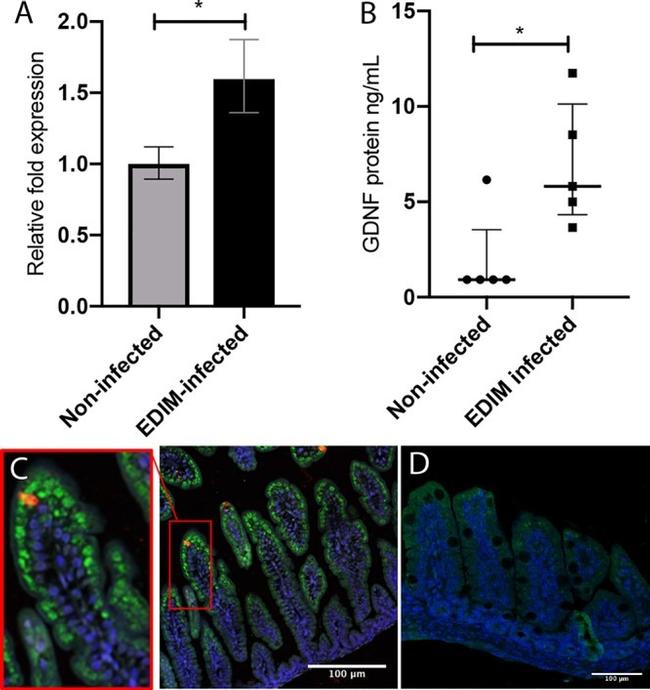 GDNF Antibody in Immunohistochemistry (IHC)