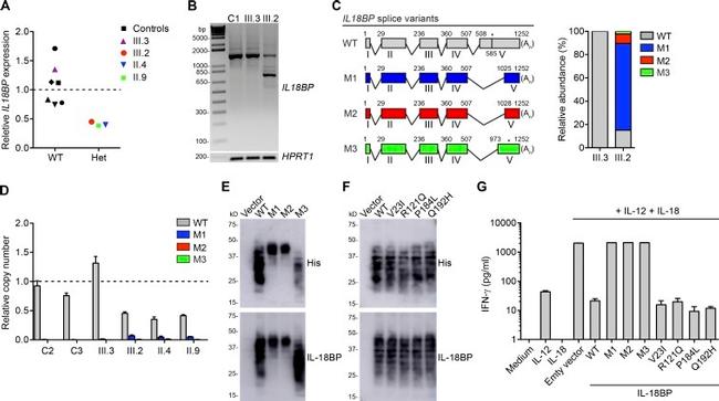 6x-His Tag Antibody in Western Blot (WB)