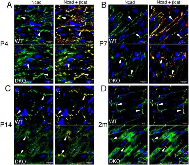 beta Catenin Antibody in Immunohistochemistry (IHC)