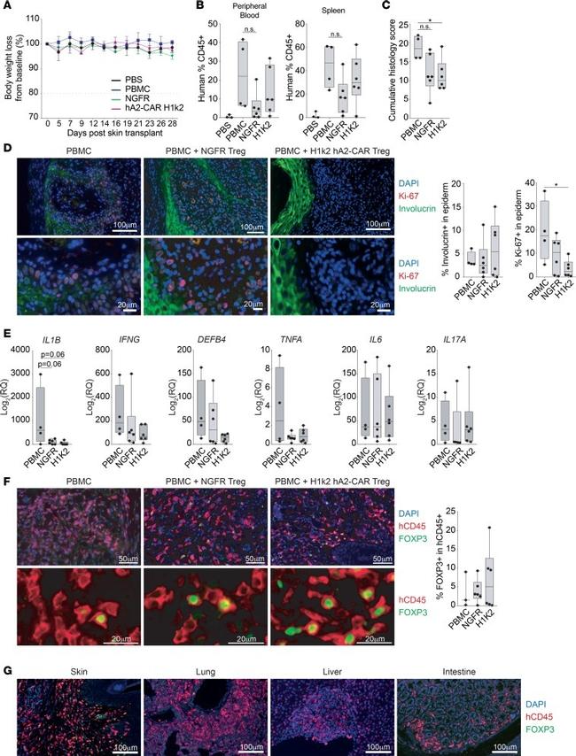 FOXP3 Antibody in Immunohistochemistry (IHC)