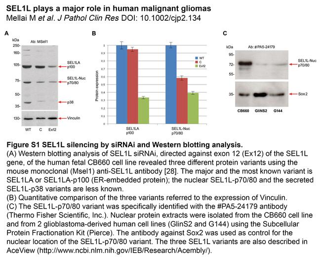 SEL1L Antibody in Western Blot (WB)