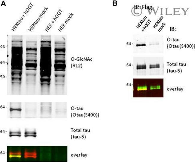 O-linked N-acetylglucosamine (O-GlcNAc) Antibody in Western Blot (WB)