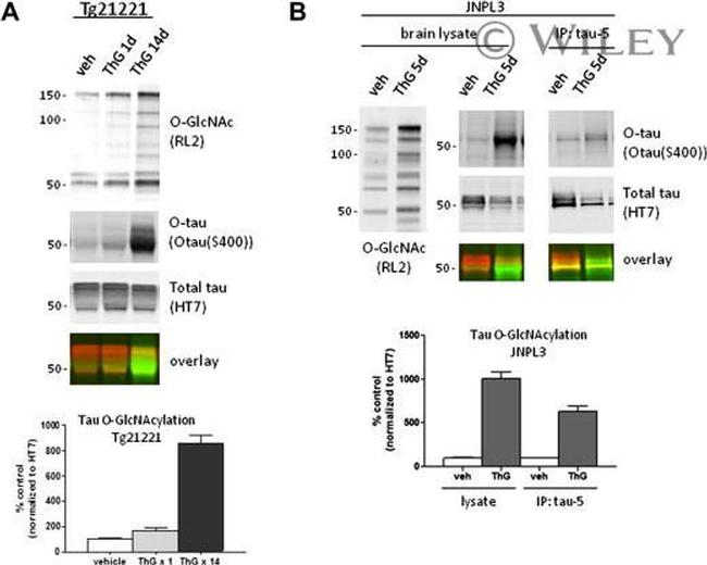 O-linked N-acetylglucosamine (O-GlcNAc) Antibody in Western Blot (WB)