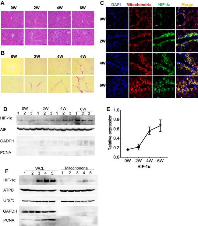 HIF1A Antibody in Immunocytochemistry (ICC/IF)