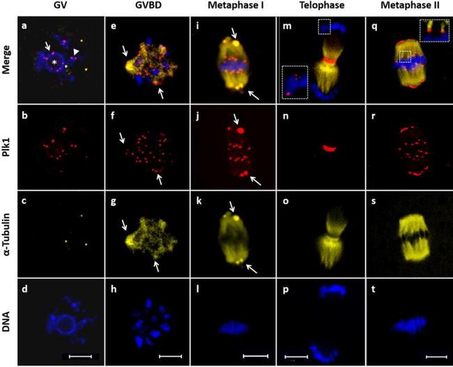 PLK1 Antibody in Immunocytochemistry (ICC/IF)