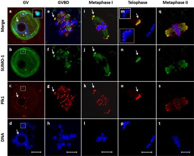 PLK1 Antibody in Immunocytochemistry (ICC/IF)