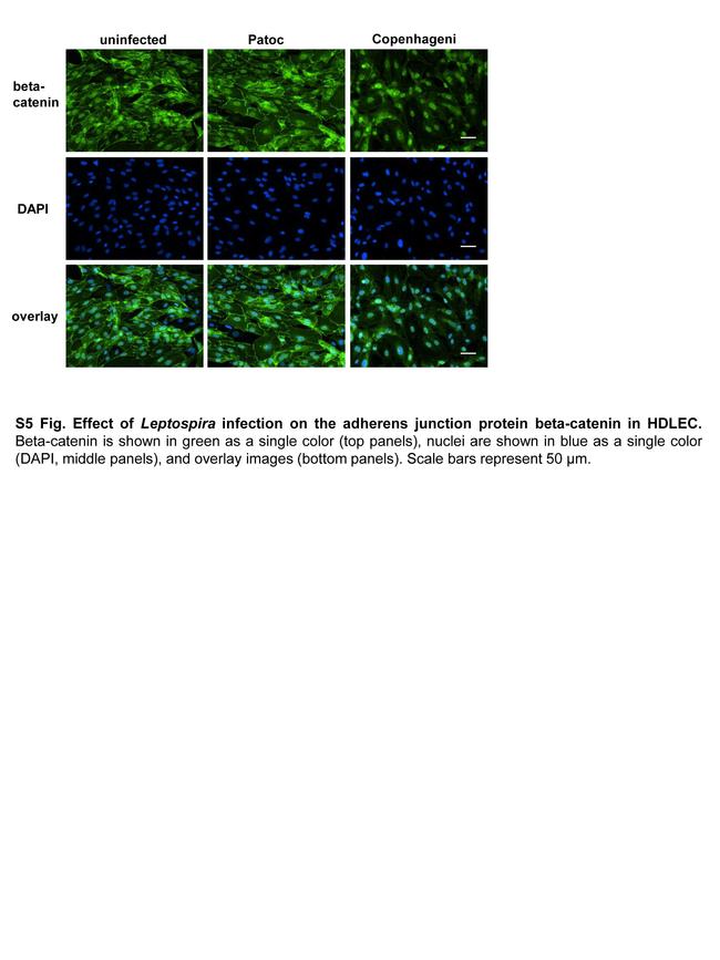 beta Catenin Antibody in Immunocytochemistry (ICC/IF)