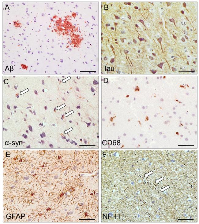 CD68 Antibody in Immunohistochemistry (IHC)