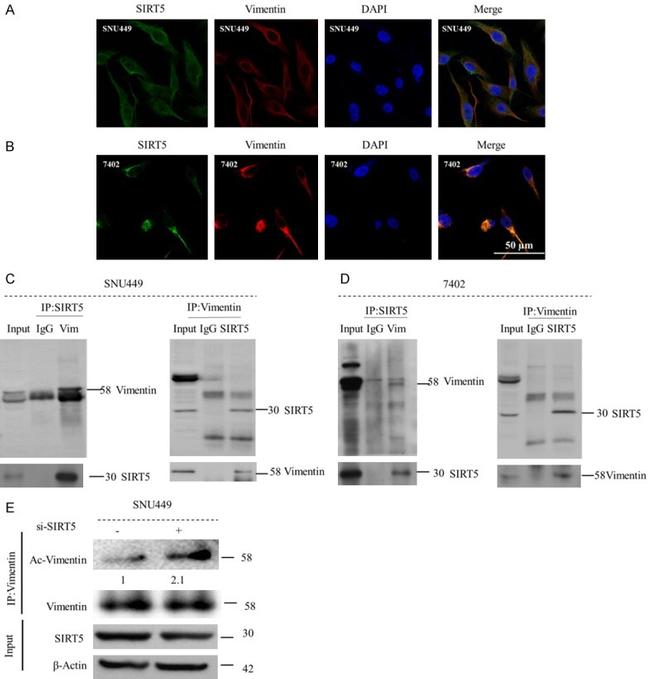 Vimentin Antibody in Immunocytochemistry, Immunohistochemistry, Immunoprecipitation (ICC/IF, IHC, IP)