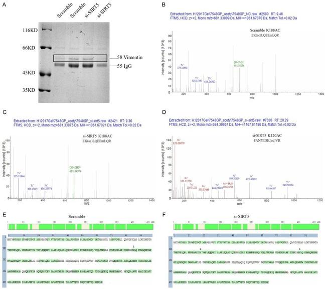 Vimentin Antibody in Western Blot (WB)