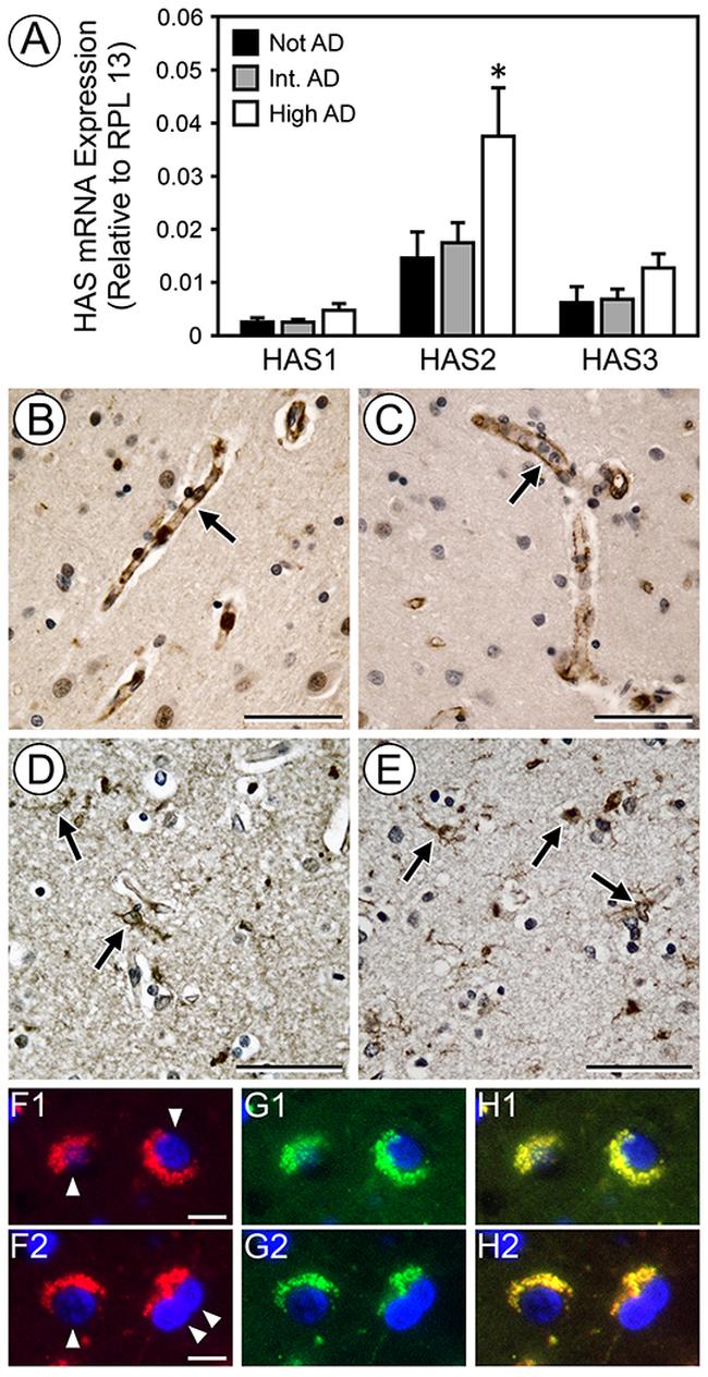 HAS2 Antibody in Immunohistochemistry (IHC)