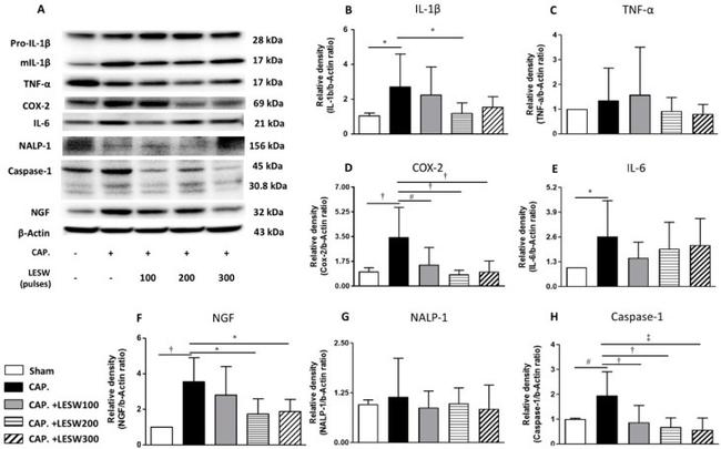 IL-6 Antibody in Western Blot (WB)