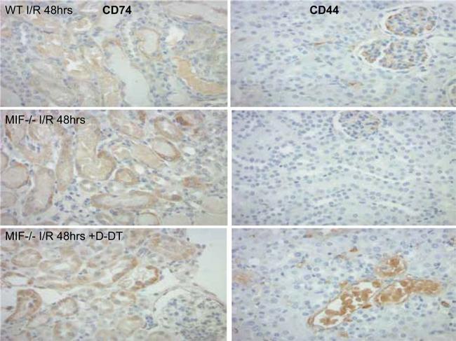 CD74 Antibody in Immunohistochemistry (IHC)