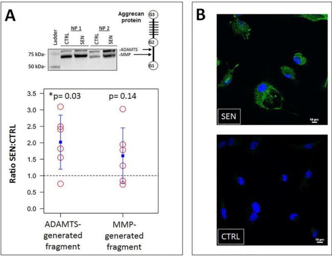 ADAMTS4 Antibody in Immunocytochemistry (ICC/IF)