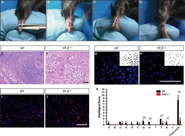 Estrogen Receptor beta Antibody in Immunohistochemistry (IHC)