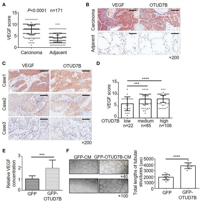 VEGF Antibody in Immunohistochemistry (IHC)