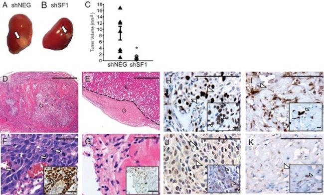 NR5A1 Antibody in Immunohistochemistry (IHC)