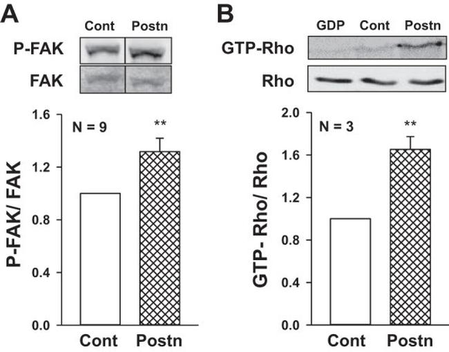 FAK Antibody in Western Blot (WB)