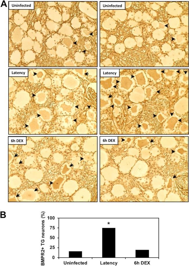 BMPR2 Antibody in Immunohistochemistry (IHC)