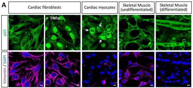 Vimentin Antibody in Immunocytochemistry (ICC/IF)