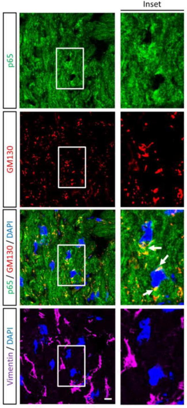 Vimentin Antibody in Immunohistochemistry (IHC)