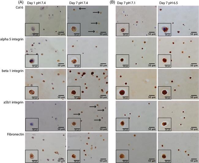 Fibronectin Antibody in Immunohistochemistry (IHC)