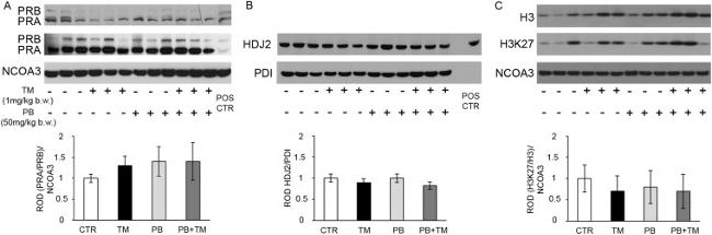 SRC3 Antibody in Western Blot (WB)