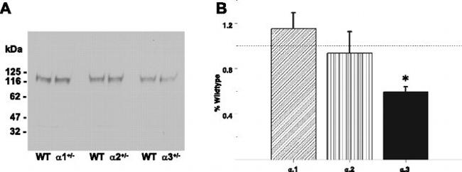 ATP1A3 Antibody in Western Blot (WB)