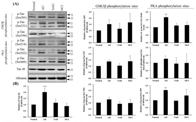 Phospho-Tau (Ser262) Antibody in Western Blot (WB)