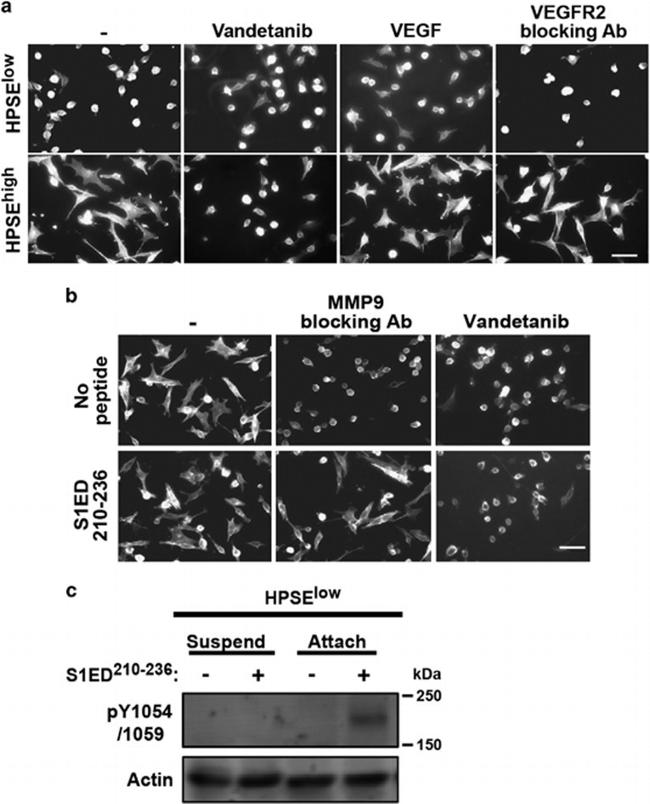 Phospho-VEGF Receptor 2 (Tyr1054, Tyr1059) Antibody in Western Blot (WB)