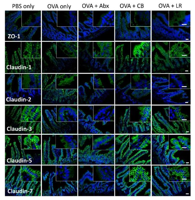 Claudin 1 Antibody in Immunohistochemistry (IHC)