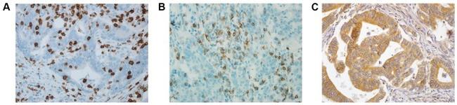 CD279 (PD-1) Antibody in Immunohistochemistry (IHC)