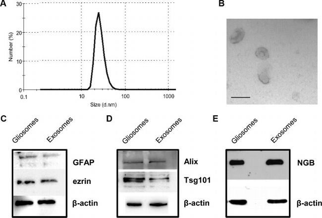 TSG101 Antibody in Western Blot (WB)