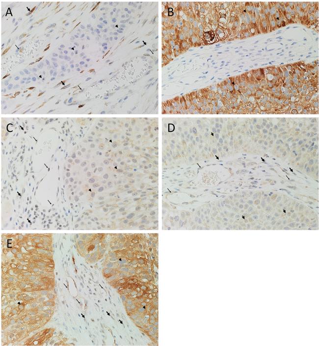 SOX2 Antibody in Immunohistochemistry (IHC)