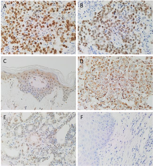 SOX2 Antibody in Immunohistochemistry (IHC)