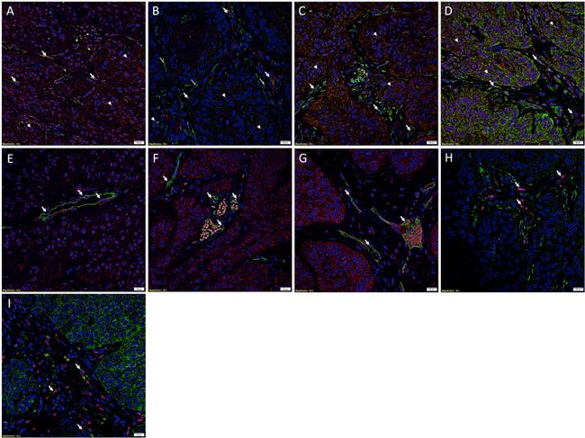 SOX2 Antibody in Immunohistochemistry (IHC)