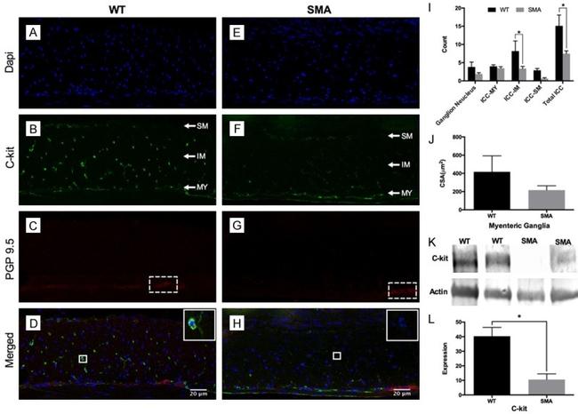 c-Kit Antibody in Western Blot, Immunohistochemistry (WB, IHC)