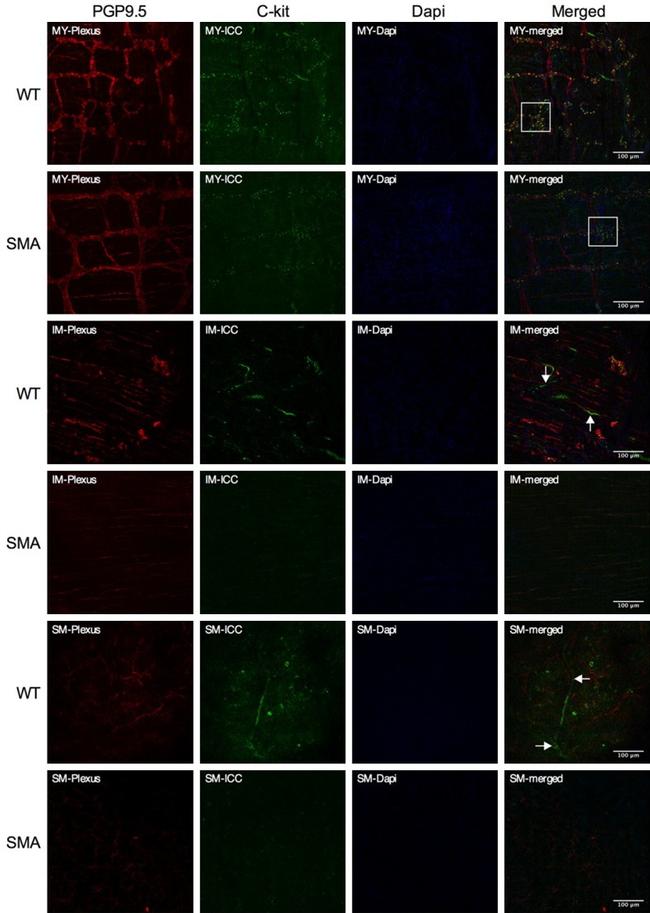 c-Kit Antibody in Immunocytochemistry (ICC/IF)