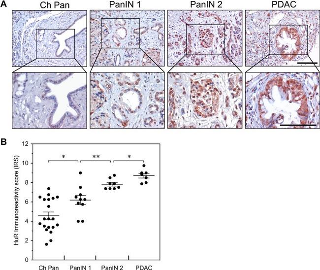 HuR Antibody in Immunohistochemistry (IHC)