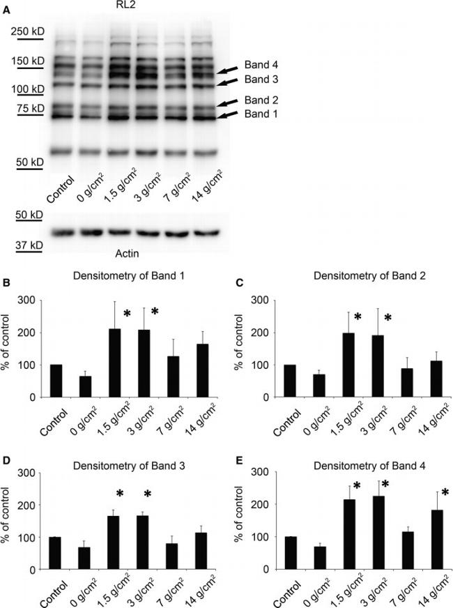 O-linked N-acetylglucosamine (O-GlcNAc) Antibody in Western Blot (WB)