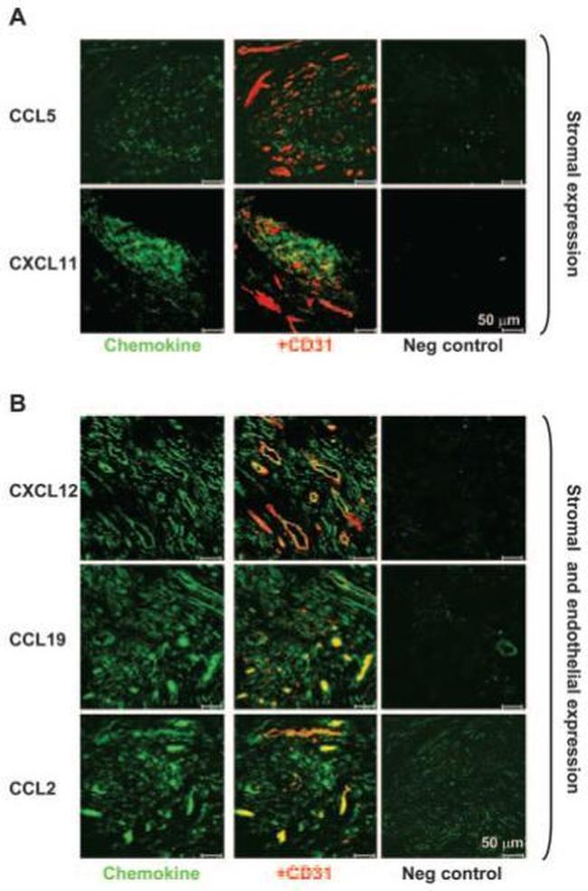 CD31 Antibody in Immunohistochemistry (IHC)