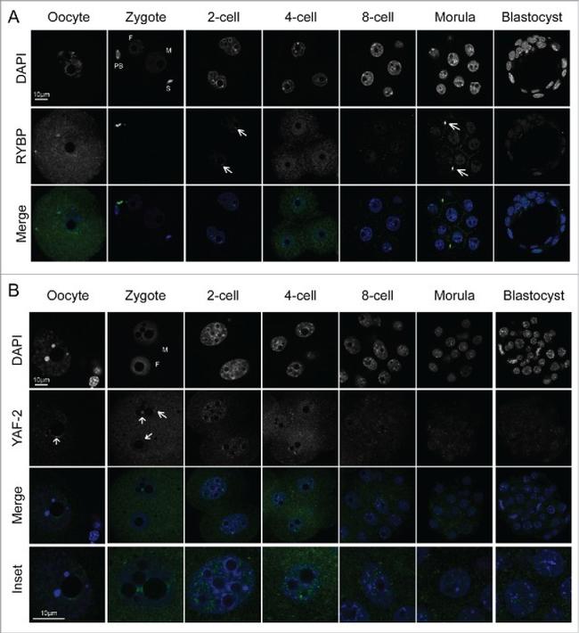 YAF2 Antibody in Immunocytochemistry (ICC/IF)