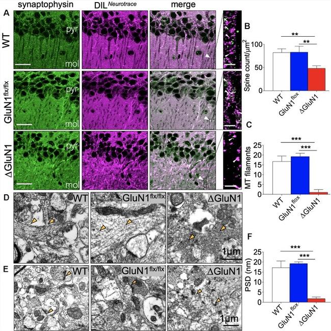 Synaptophysin Antibody in Immunohistochemistry (IHC)