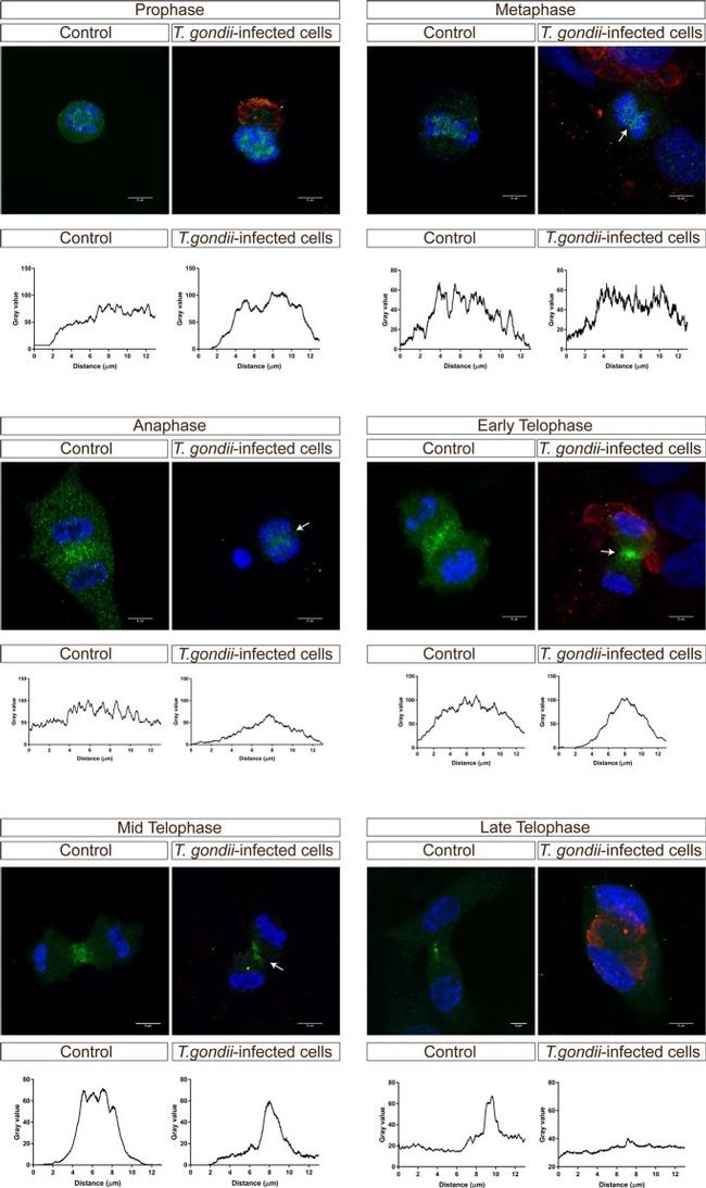 Toxoplasma gondii Antibody in Immunocytochemistry (ICC/IF)