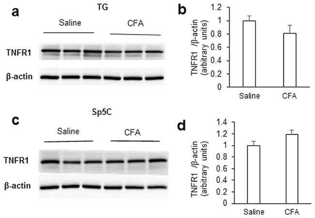 TNF alpha Antibody in Western Blot (WB)