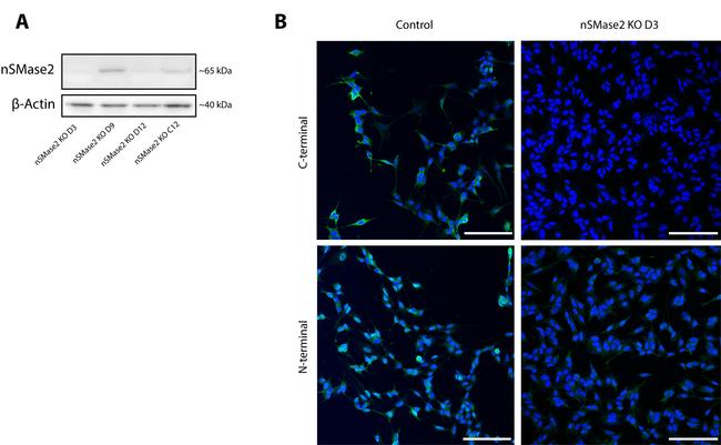 SMPD3 Antibody in Western Blot (WB)