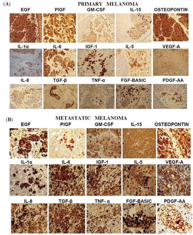 IL-8 (CXCL8) Antibody in Immunohistochemistry (IHC)