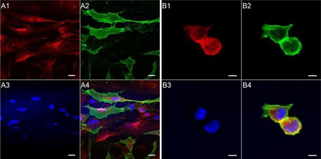 SSEA3 Antibody in Immunocytochemistry (ICC/IF)