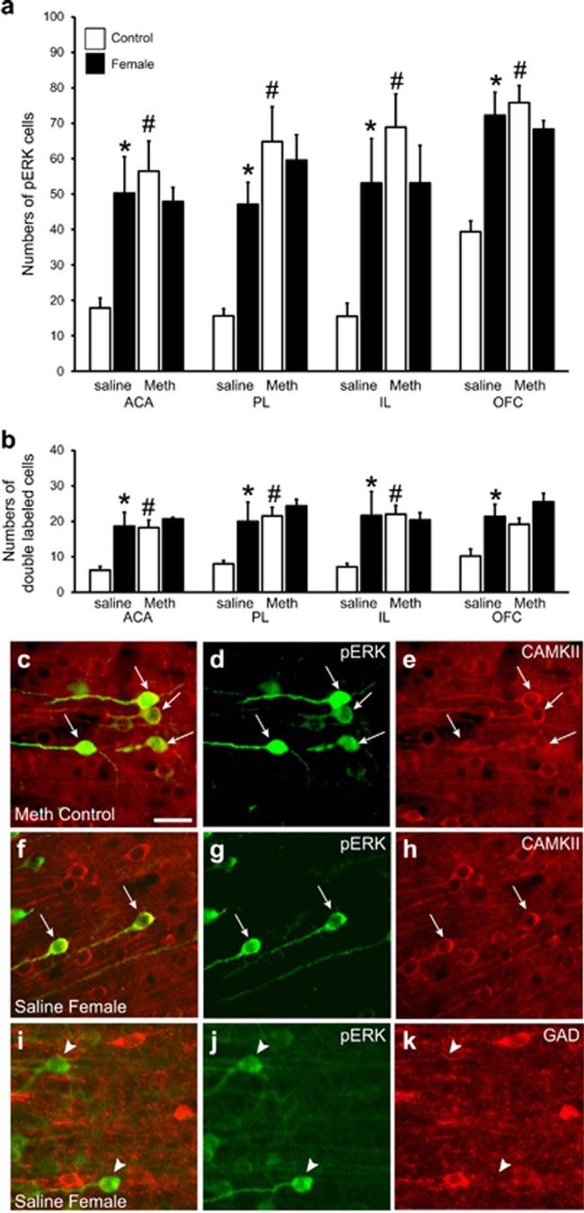 CaMKII alpha Antibody in Immunohistochemistry (IHC)